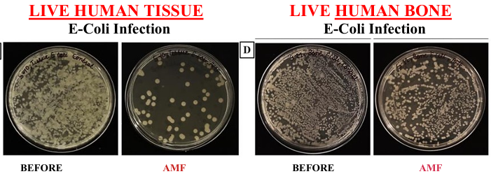 Live Human and Bone Tissue Example