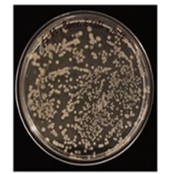 Human infected bone treated